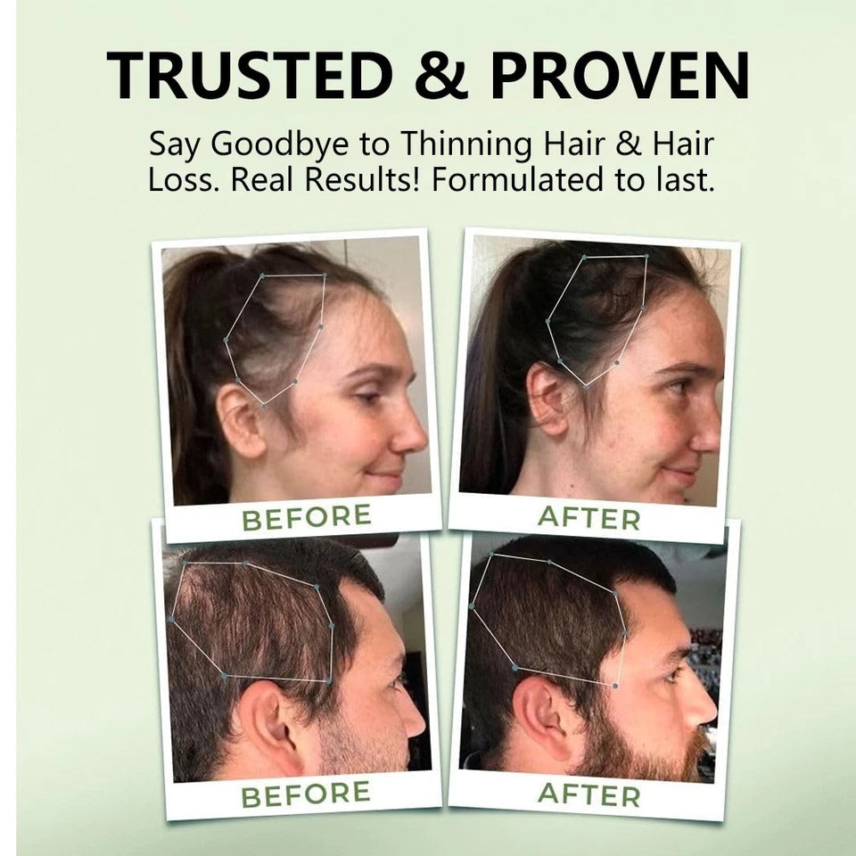 Hair Complex Supplement Increased Body Defenses Supports Skin Nails Cell Health
